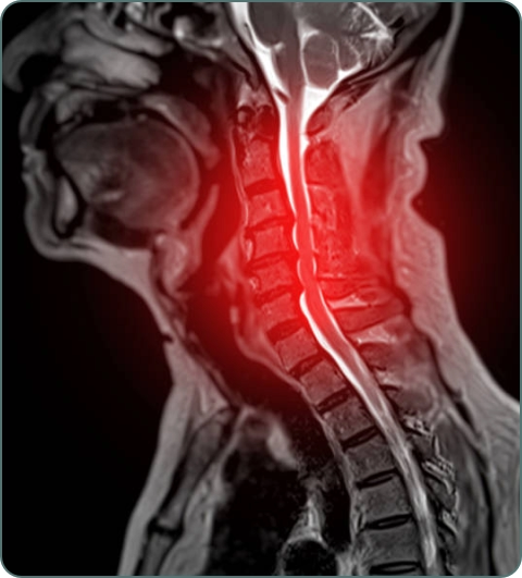 Physiotherapy diagnostic investigations imagery