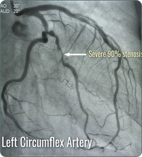 Cardiac diagnostic investigations imagery