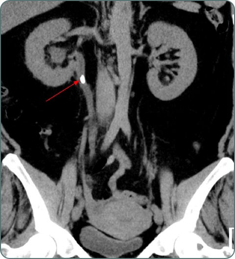 Urological diagnostic investigations imagery