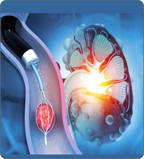Urological treatments and procedures imagery