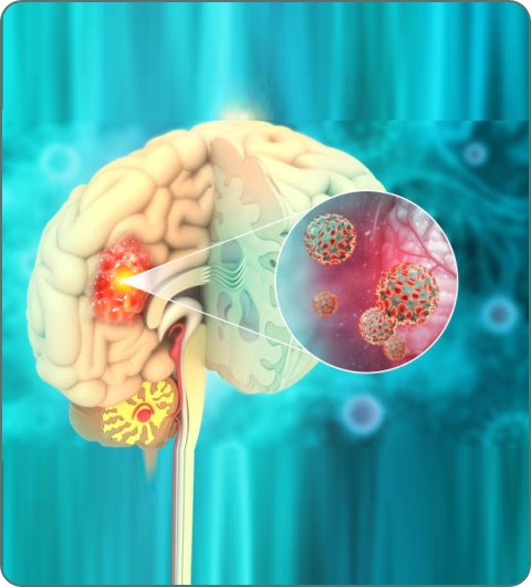 Neuro spine surgery illustration